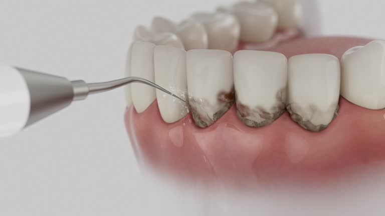 Reliable Dental contractor in Camino Tassajara, CA by Dentist Open Now